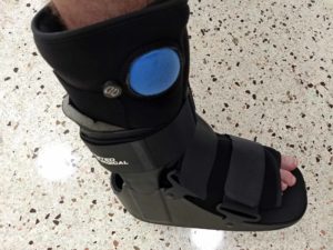 Tips to Heal a Sprained Ankle